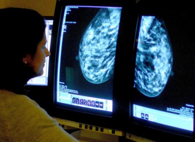 A consultant examines a mammogram for signs of breast cancer.