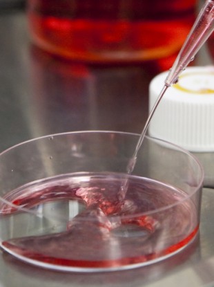 File photo of stem cell research.