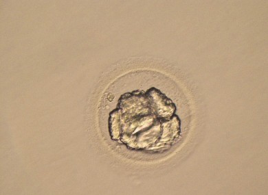 A human embryo after it has been dehydrated.