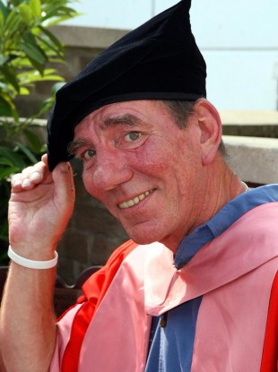Pete Postlethwaite, seen in 2007 receiving an honorary degree. He died yesterday at the age of 64.