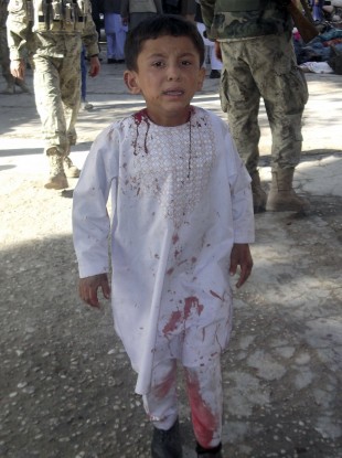 An Afghan boy, who lost his father in a suicide attack, walks around a hospital in a daze in Maymana, Faryab province north west of Kabul, Afghanistan, Friday, Oct. 26, 2012.