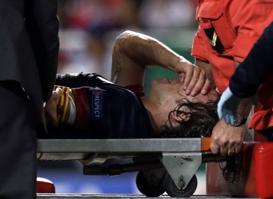 Barcelona's Carles Puyol is carried on a stretcher after injuring his arm in a fall during their Champions League group G match with Benfica.