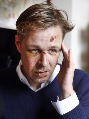 Wilfred de Bruijn, who was beaten unconscious near his home in central Paris.