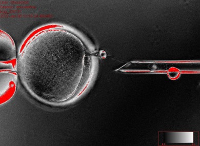 The egg cell nucleus extracted and placed in a pipette