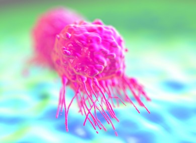 Breast cancer cells separating
