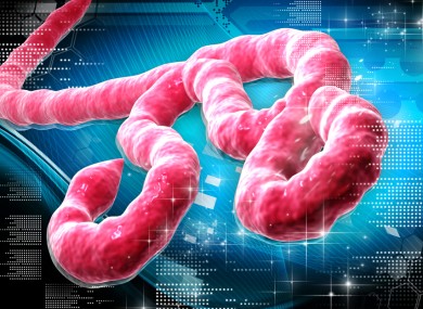 Ebola virus