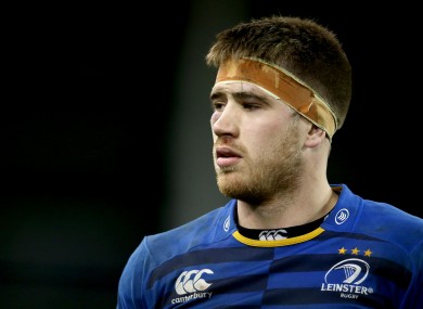 Ryan sporting a swollen eye after last weekend's game.