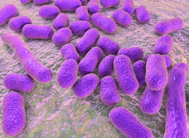 The antibiotic resistant superbug can be fatal patients who contract it.