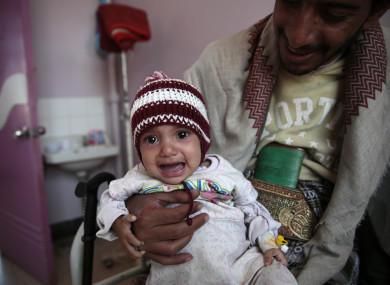 A man carries his malnourished girl at a therapeutic feeding centre in a hospital in Sanaa, Yemen.