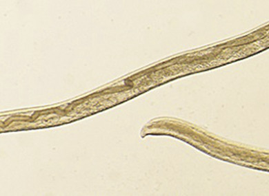 This undated photo provided by the Centers for Disease Control and Prevention (CDC) shows Thelazia gulosa.