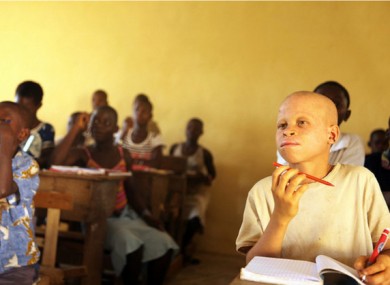 An Albino student (right) attends school in Niambly, near Duekoue, Côte d’Ivoire.