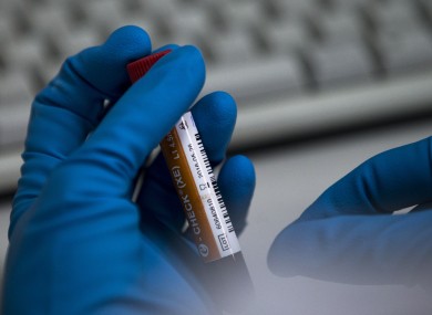 Samples during the Games may now be sent overseas.