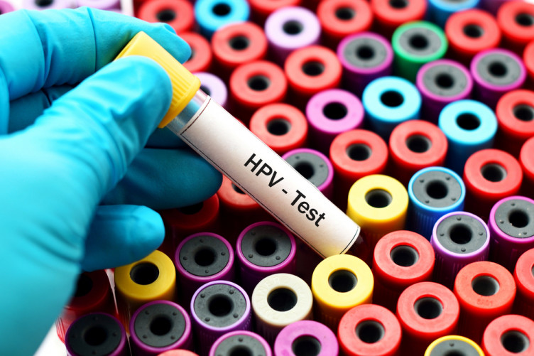 hpv virus pozitivan pastile pentru viermi în stomac