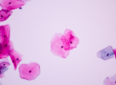 Normal squamous epithelial cells of cervical woman on white background view in microscopy.