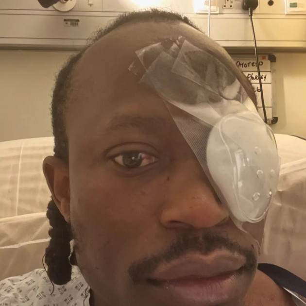Gardaí investigating after Limerick hip hop artist partially blinded in baseball bat assault